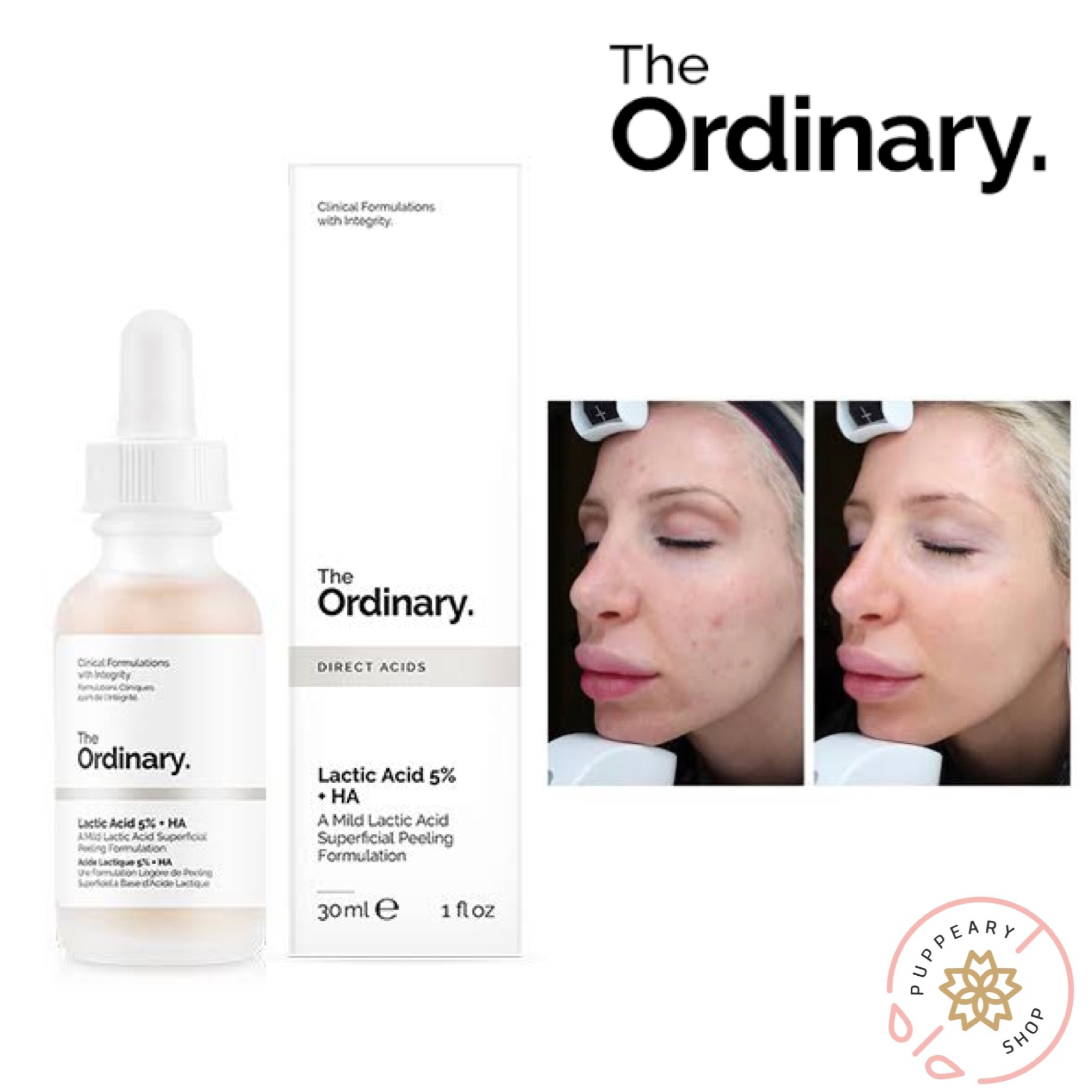 (แท้/พร้อมส่ง) THE ORDINARY DIRECT ACIDS LACTIC ACID 5% + HA 30ML