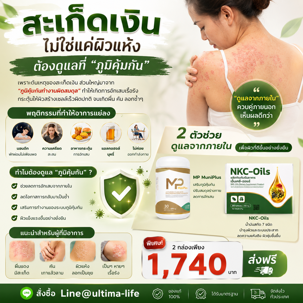 Muniplus + NKC oils ดูแลสะเก็ดเงิน