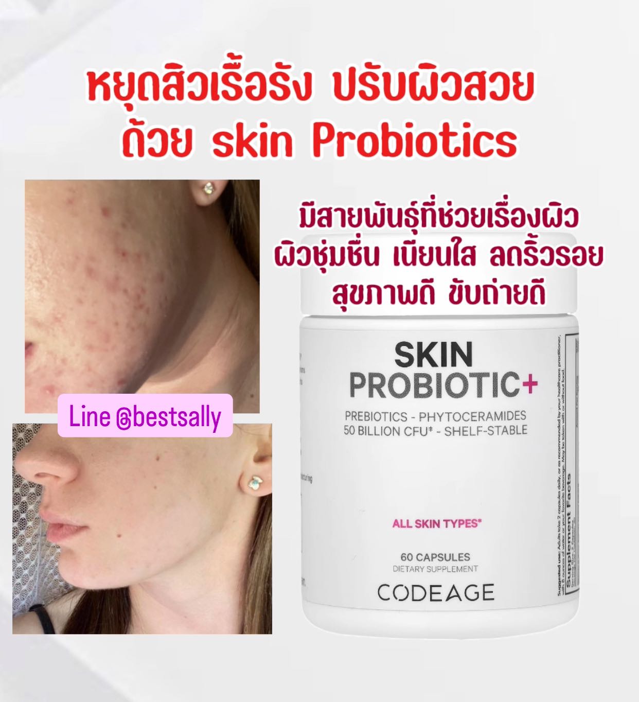 Codeage  Skin Probiotic  Shelf-Stable  50 Billion CFU  60 Capsules