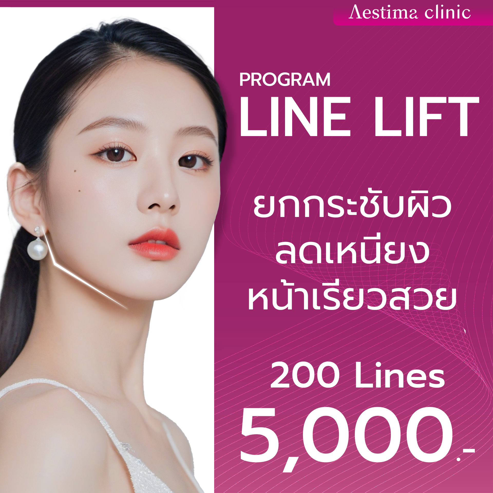 Hifu LineLift ยกกระชับสลายไขมันเเก้มและเหนียง 
