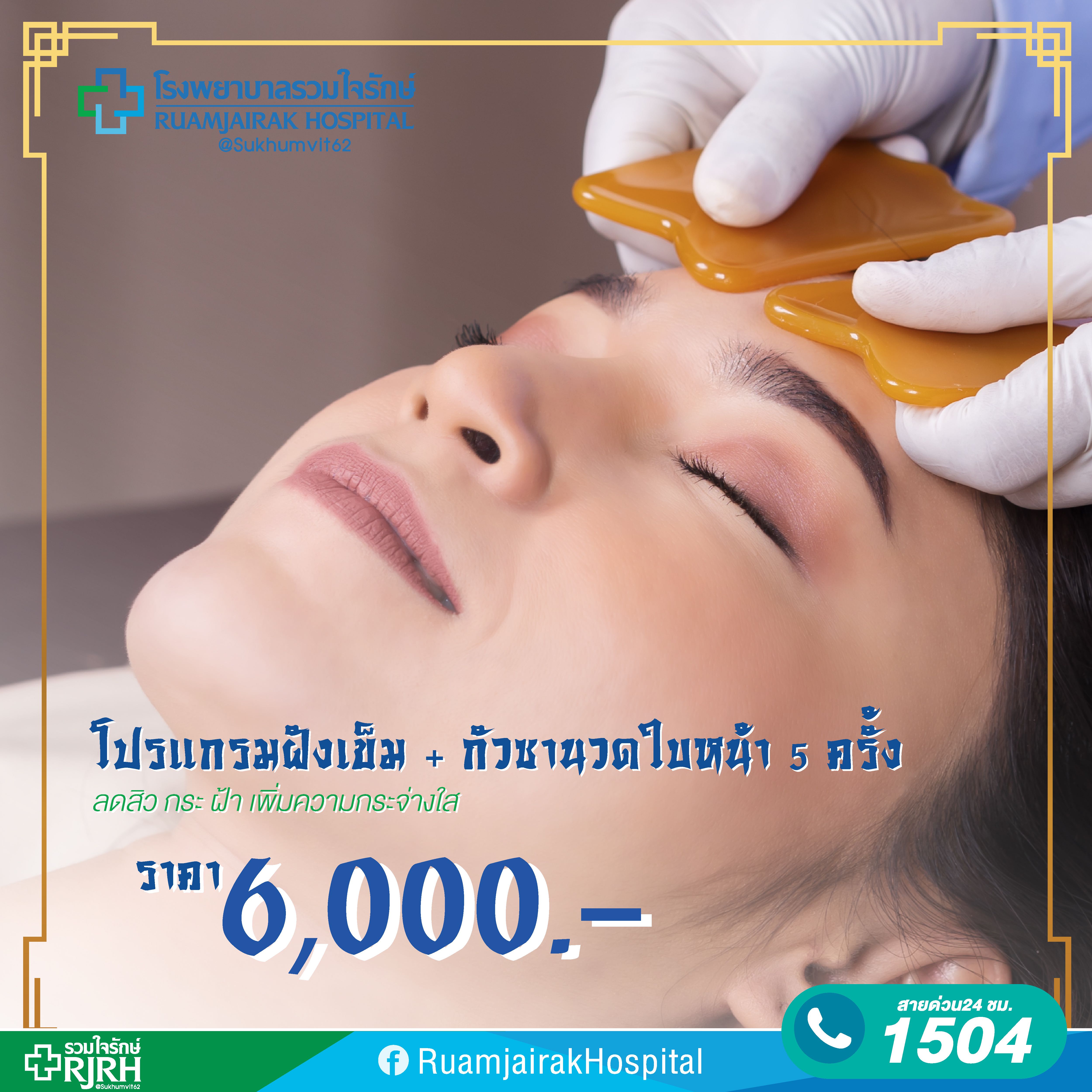 โปรแกรมฝังเข็ม + กัวซานวดใบหน้า 5 ครั้ง โรงพยาบาลรวมใจรักษ์