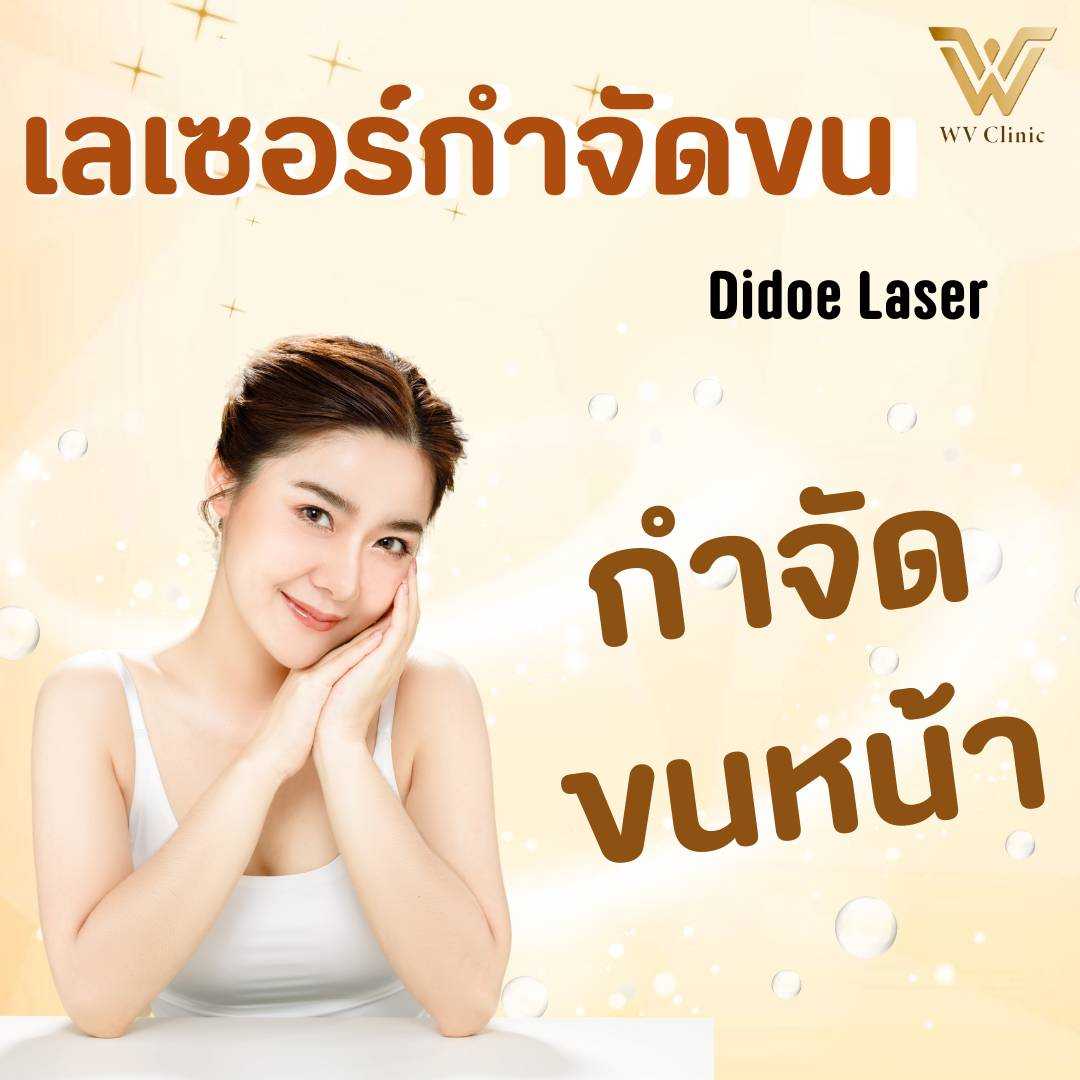 กำจัดขน ขนหน้า (Didoe Laser)