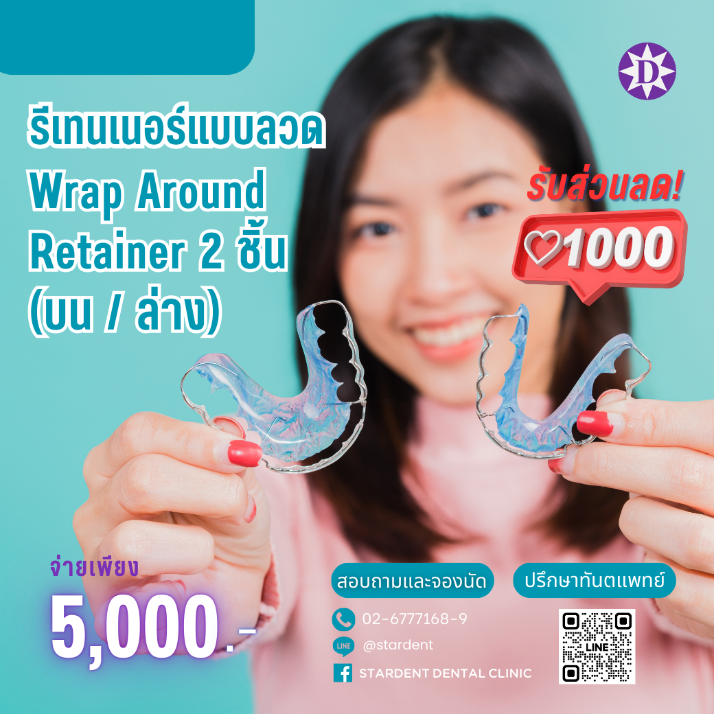 รีเทนเนอร์แบบลวด 2 ชิ้น