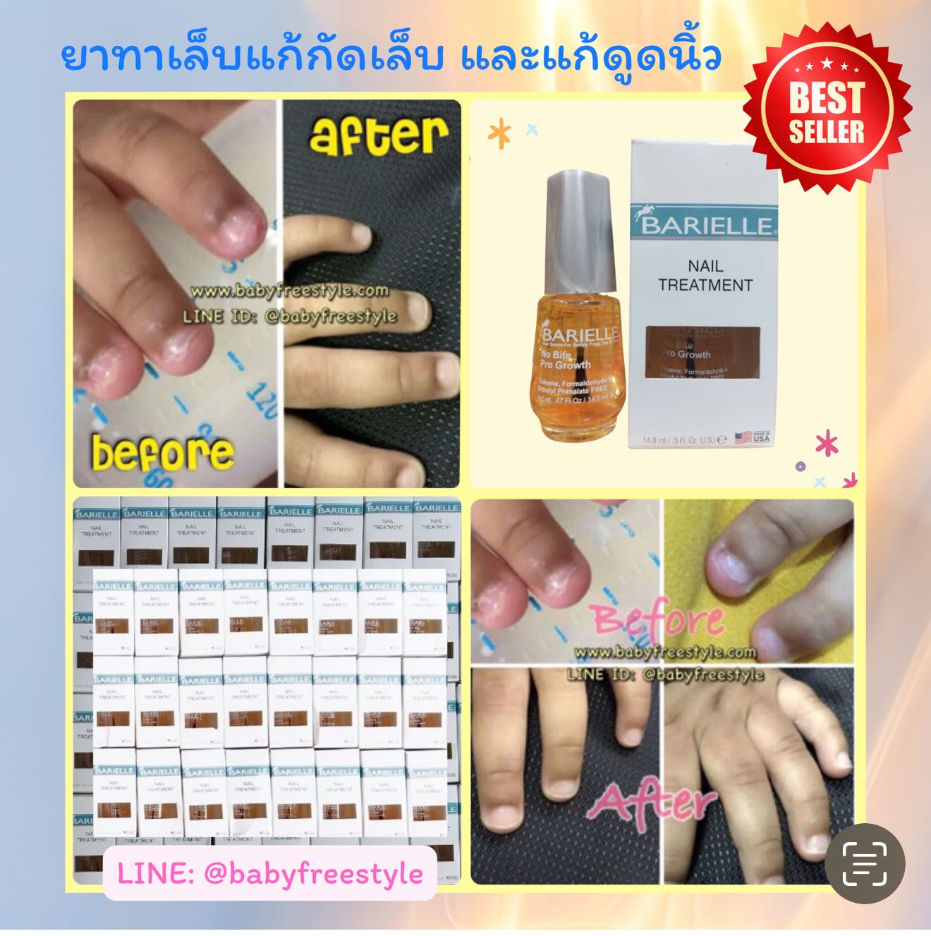 ยาทาเล็บแก้กัดเล็บและแก้ดูดนิ้ว Barielle สินค้านำเข้าจาก USA 🇺🇸 ได้ผลดีเยี่ยม