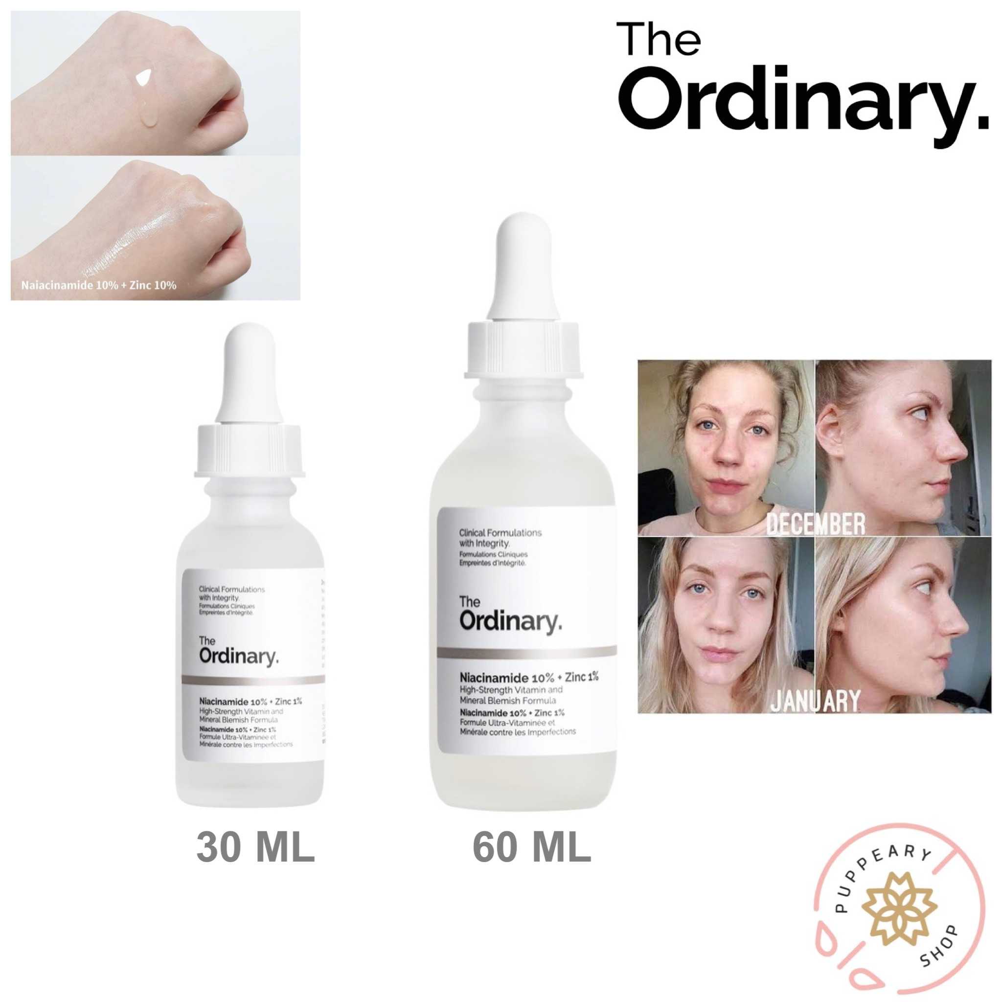 (แท้/พร้อมส่ง) THE ORDINARY NIACINAMIDE 10%+Zinc 1%