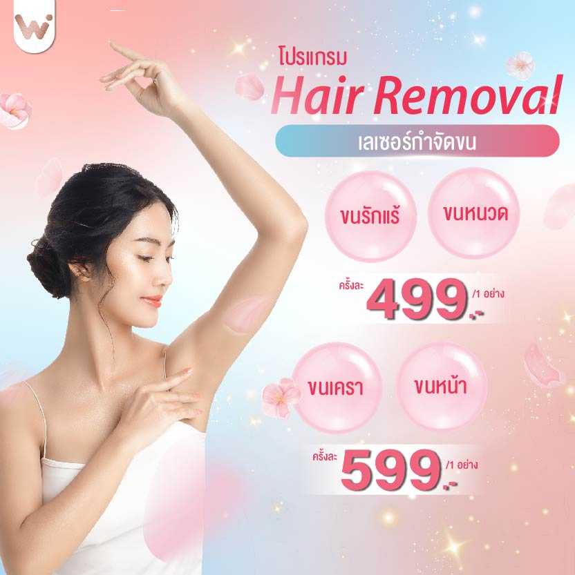เลเซอร์กำจัดขน