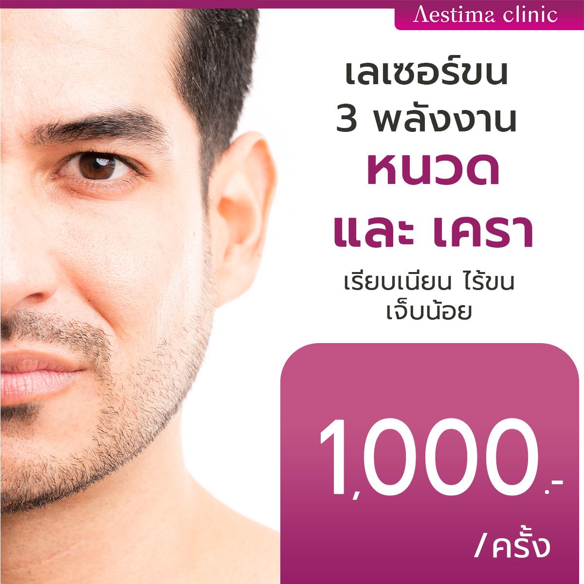 ✨ เลเซอร์กำจัดขนถาวร 3 พลังงาน หนวดเเละเครา ✨