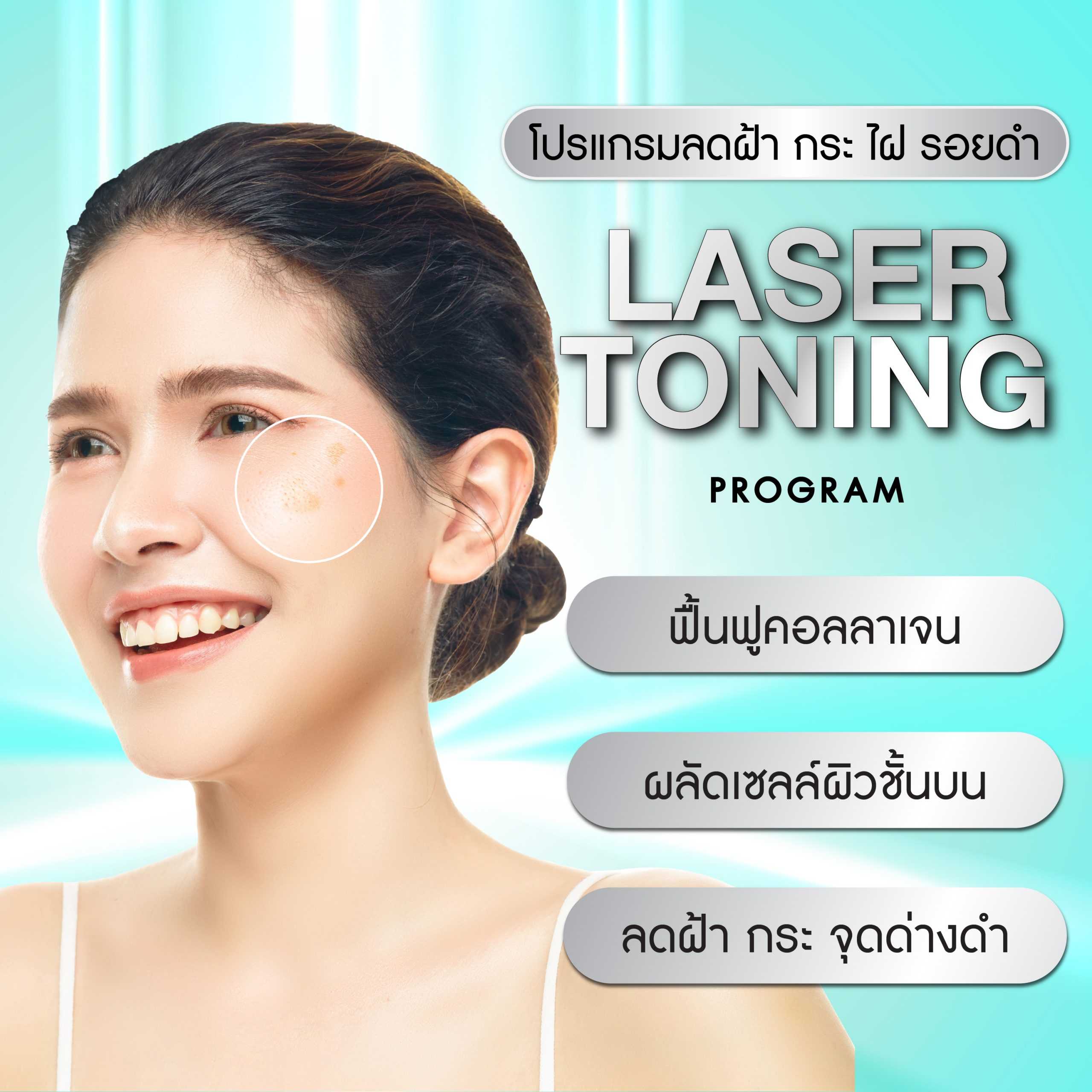 Laser toning 5 ครั้ง