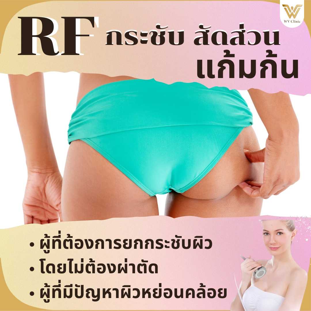 สลายไขมันด้วยความร้อนโฟโน(RF) แก้มก้น
