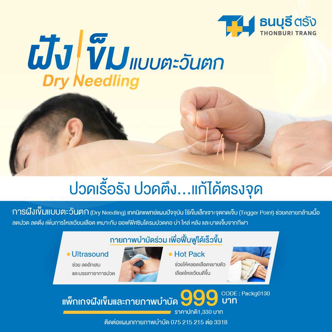 ฝังเข็มแบบตะวันตก DryNeedling
