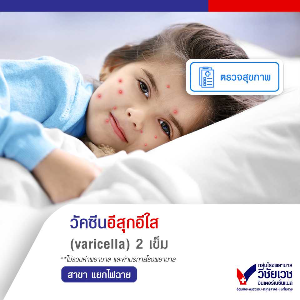 วัคซีนอีสุกอีใส (varicella) 2 เข็ม