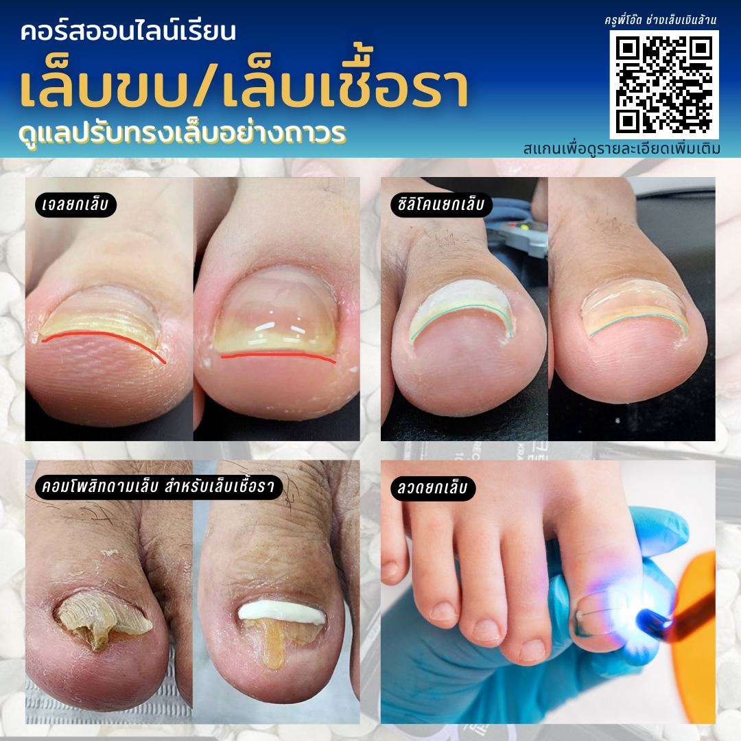คอร์สเรียนดูแลปรับทรงเล็บ แก้ปัญหาเล็บขบ