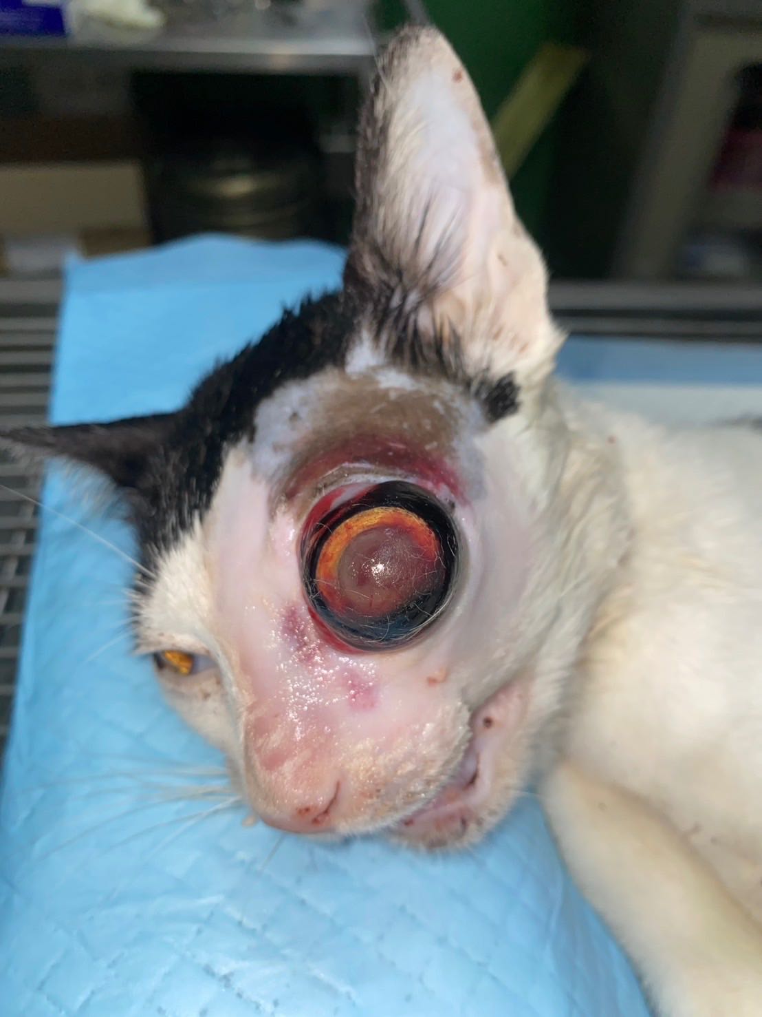 บริจาค เคสที่ 2286 น้องดำทวีวัฒนา รถชนตาถลน กรามหัก