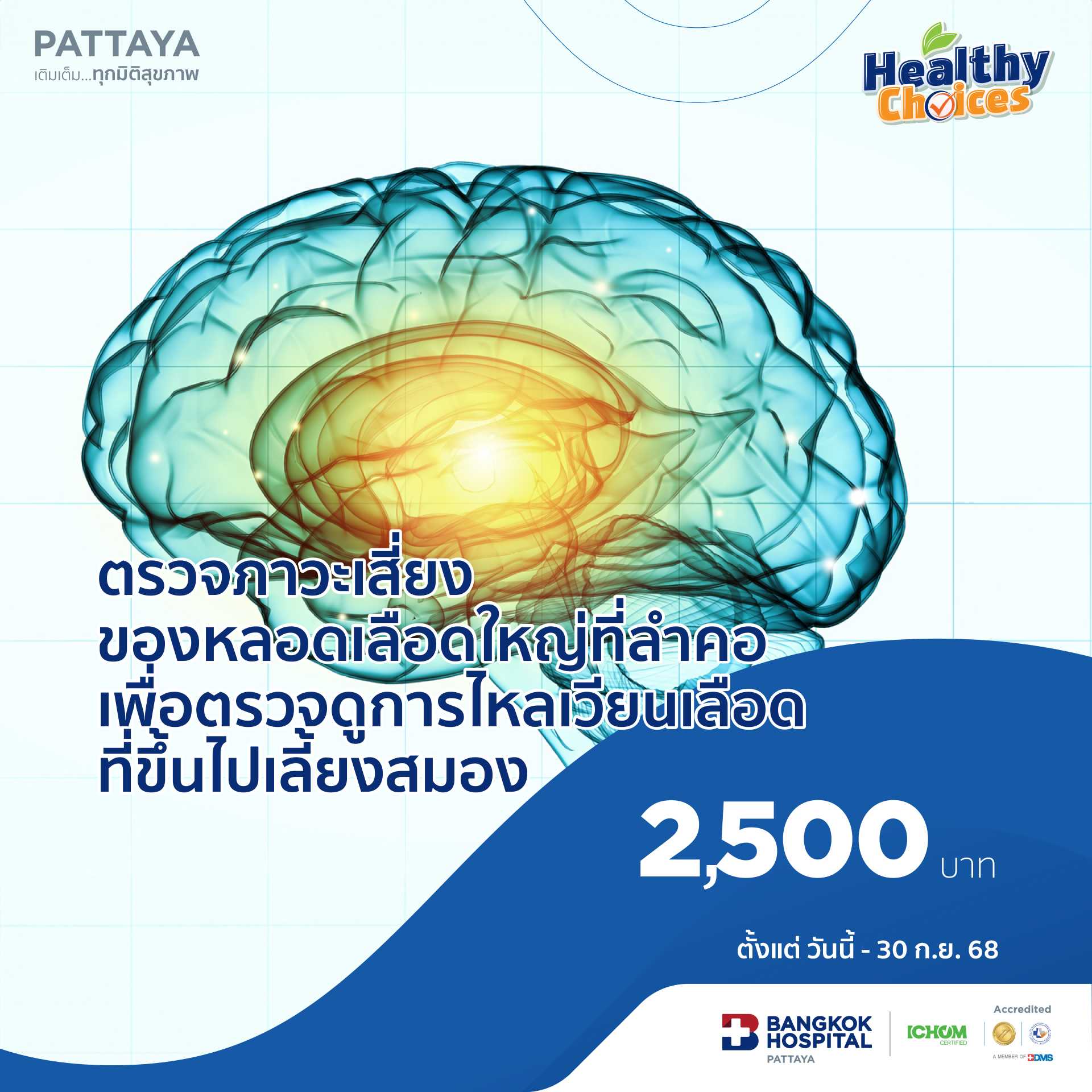 ตรวจภาวะเสี่ยงของหลอดเลือดใหญ่ที่ลําคอเพื่อตรวจดูการไหลเวียนเลือด ที่ขึ้นไปเลี้ยงสมอง