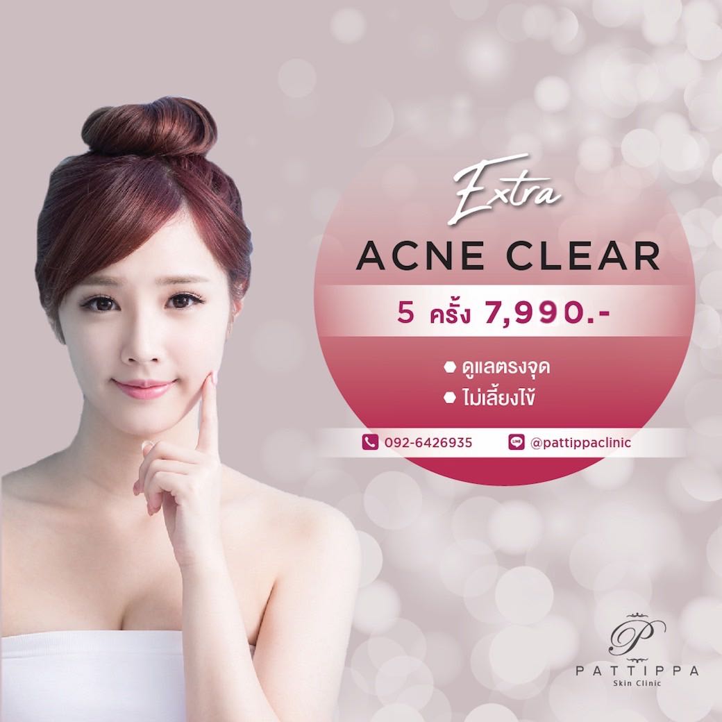 Acne clear 5 ครั้ง