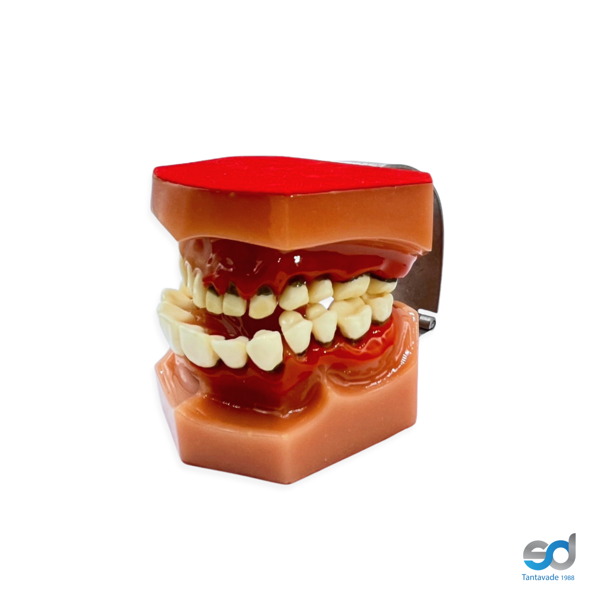 โมเดลชุดโรคปริทันต์