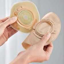 Flexima 3S แป้นและถุงทวารเทียม รุ่นพัฒนาต่อ ใส่สบายขึ้นปรับมุมได้ 3 ระดับ