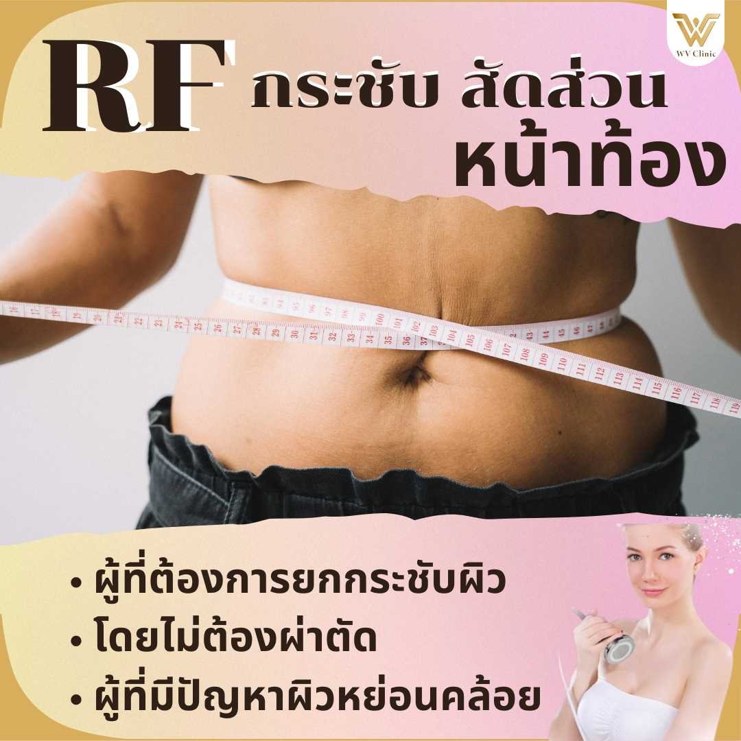 สลายไขมันด้วยความร้อนโฟโน(RF) หน้าท้อง