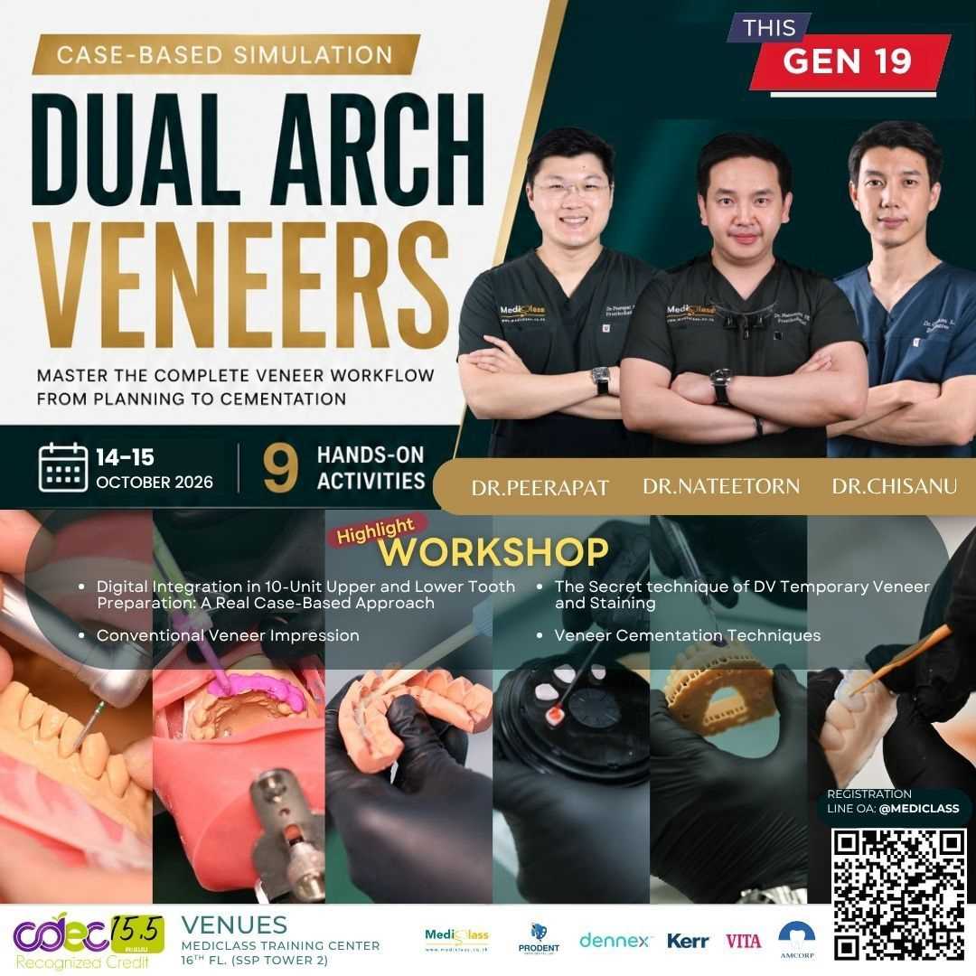 Dual Arch Veneers  Gen 19