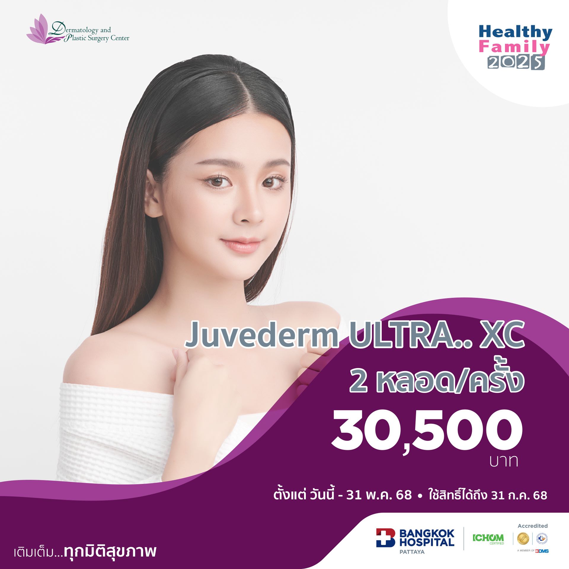 Juvederm ULTRA.. XC.  2 หลอด/ครั้ง