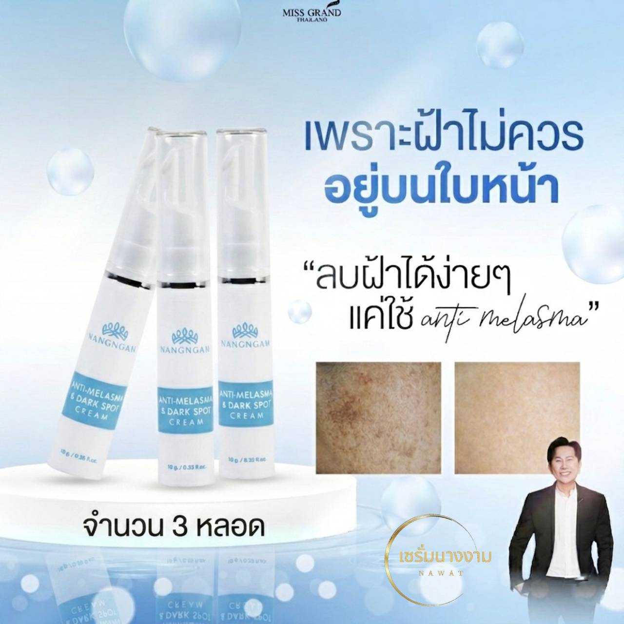 ครีมทาฝ้านางงาม 3 หลอด Anti-Melasma & Dark Spot Cream แอนตี้-เมลาสมา แอนด์ ดาร์ก สปอต ครีม
