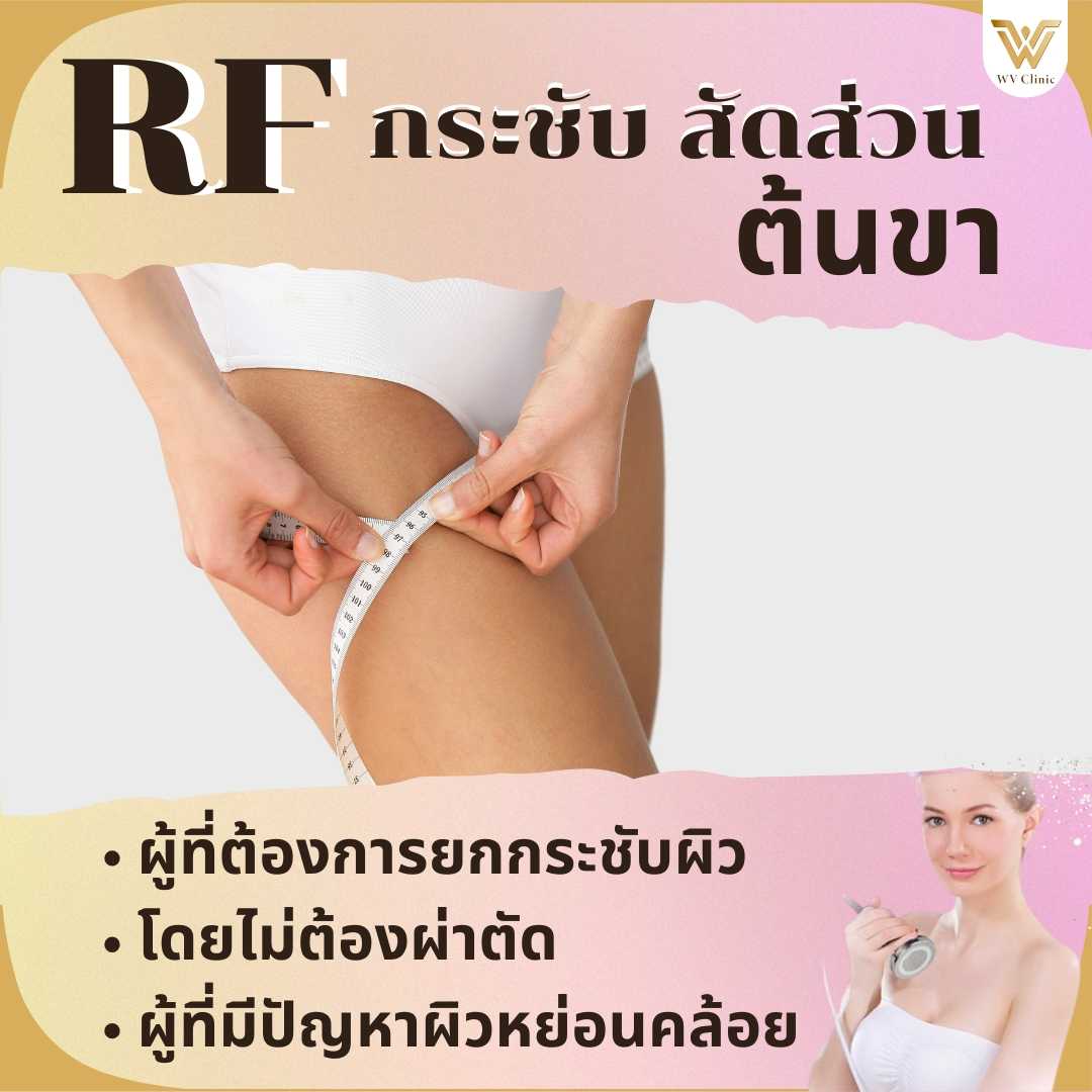 สลายไขมันด้วยความร้อนโฟโน(RF) ต้นขา