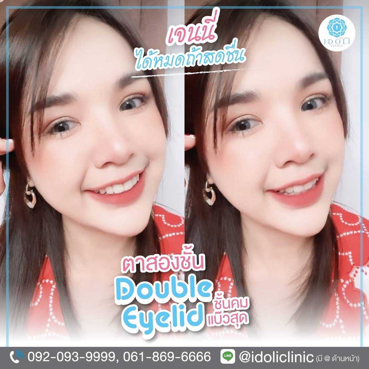 ตาสองชั้น Dolly Eyes
