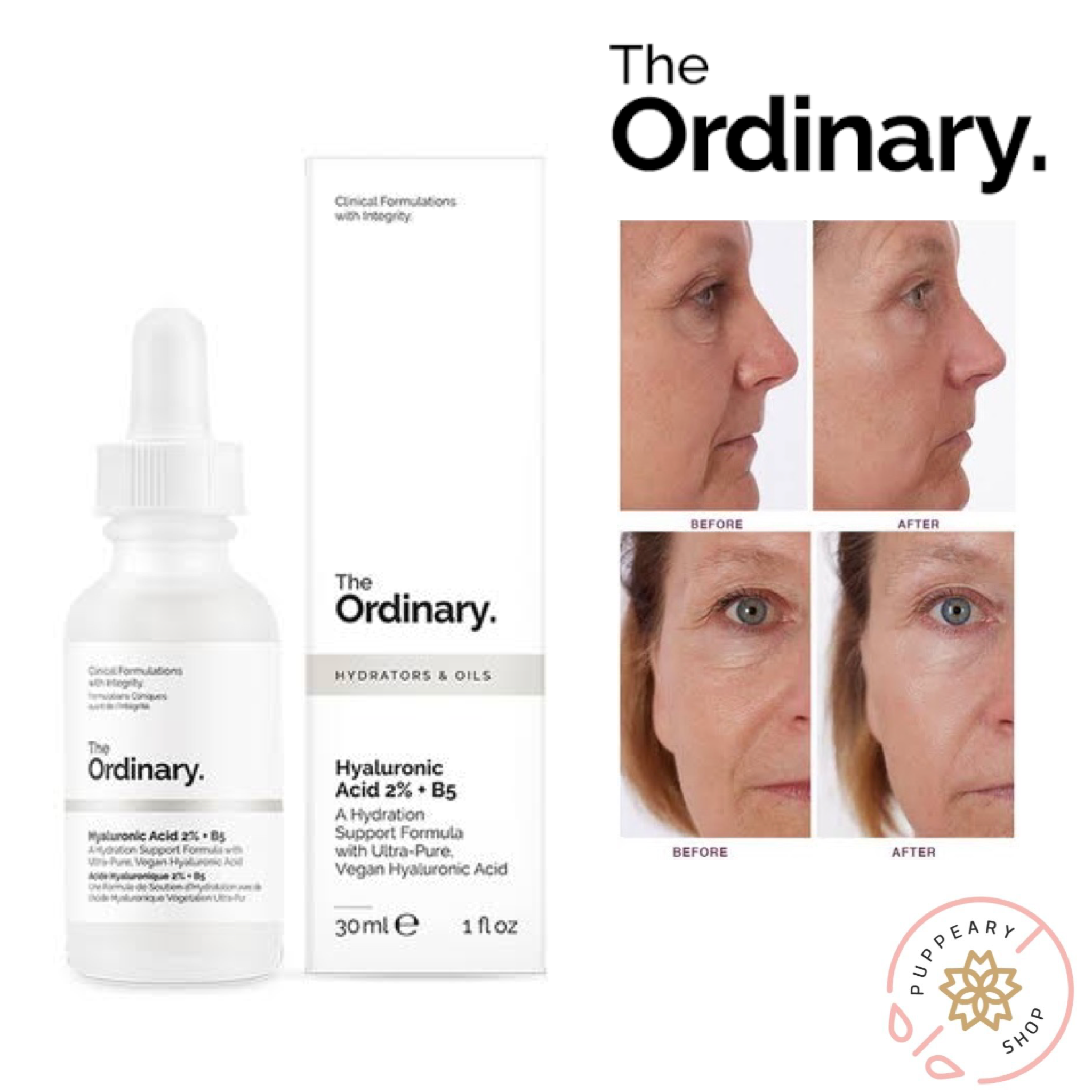 (แท้/พร้อมส่ง) THE ORDINARY HYALURONIC ACID 2% + B5 30ML