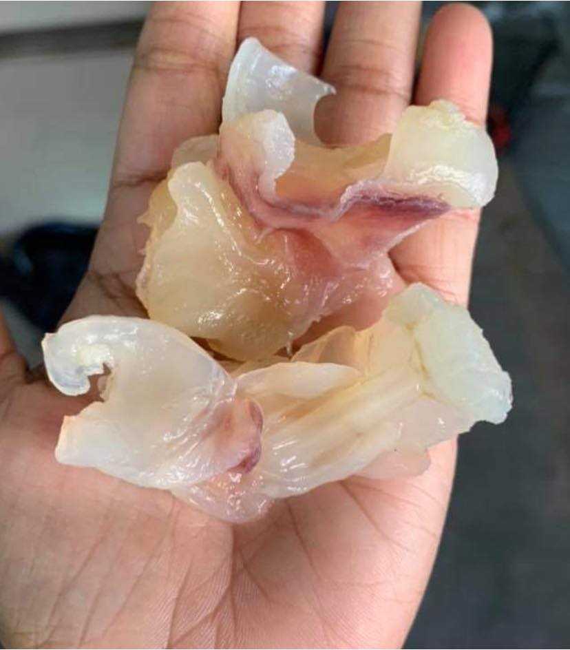 เอ็นแก้วหมึก 35฿
