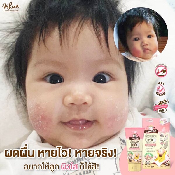 ครีมทาลดผดผื่น ป้องกันผดผื่น บำรุงผิว ครีมแป้ง แครี่บี ไรซ์พาวเดอรี่ 35 กรัม สูตรแห้งไว KHUN Organic