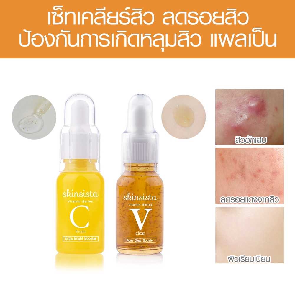 เซ็ทคู่ราคาพิเศษ!!! Skinsista เซ็ทเคลียร์สิว ลดรอยสิว ป้องกันการเกิดหลุมสิว แผลเป็น