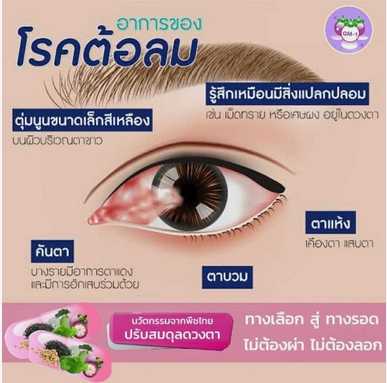งานวิจัยภูมิสมดุลดวงตา สูตร ต้อลม