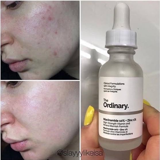  The Ordinary Niacinamide 10% + Zinc 1%