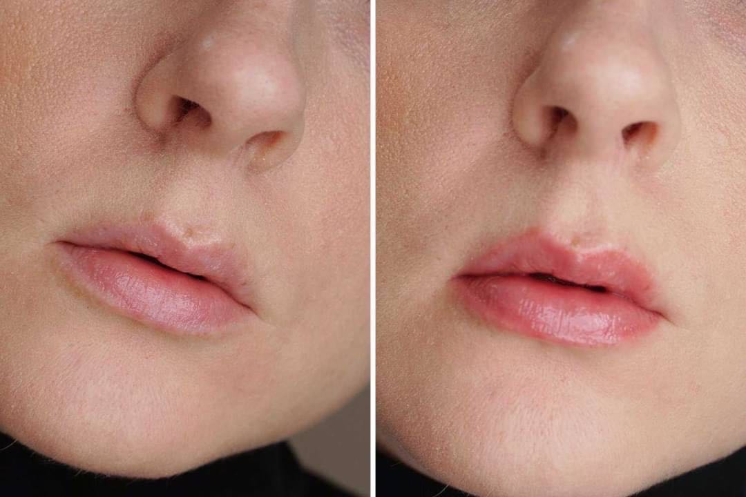Too Faced Lip Injection Extreme 1.5ml