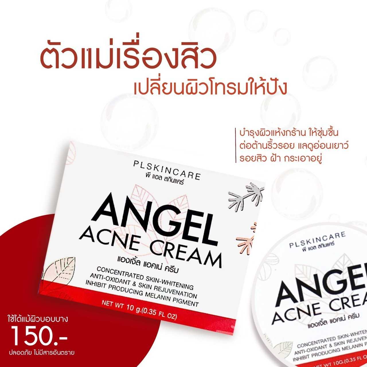 Angel Acne Cream : แองเจิ้ล แอคเน่ ครีม