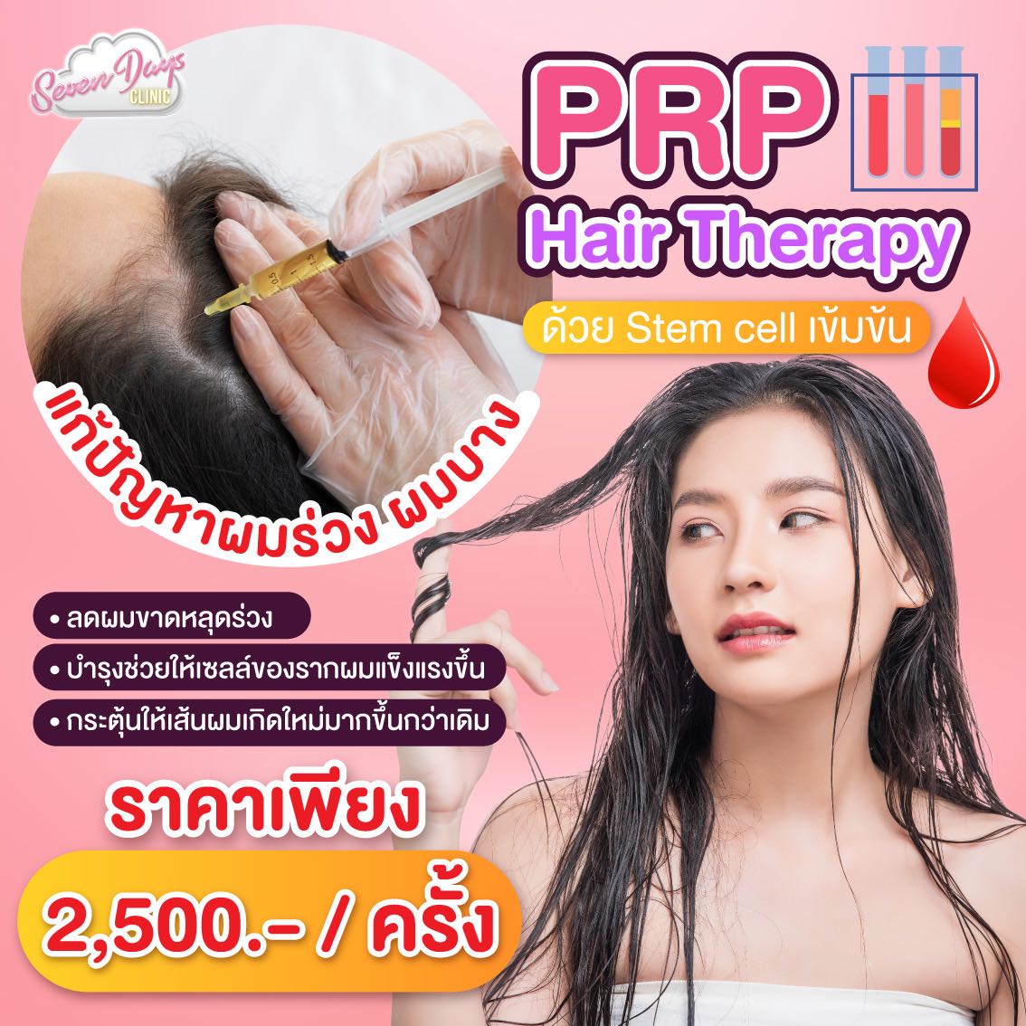 PRP Hair แก้ผมบาง 1 ครั้ง 2,500.-