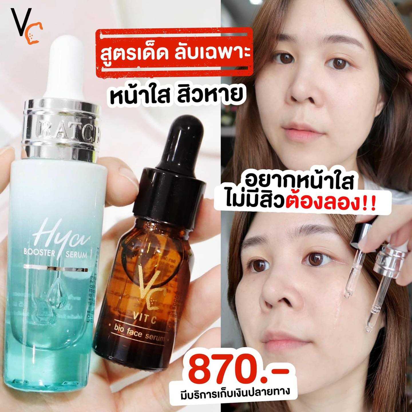 ไฮยา+วิตซี