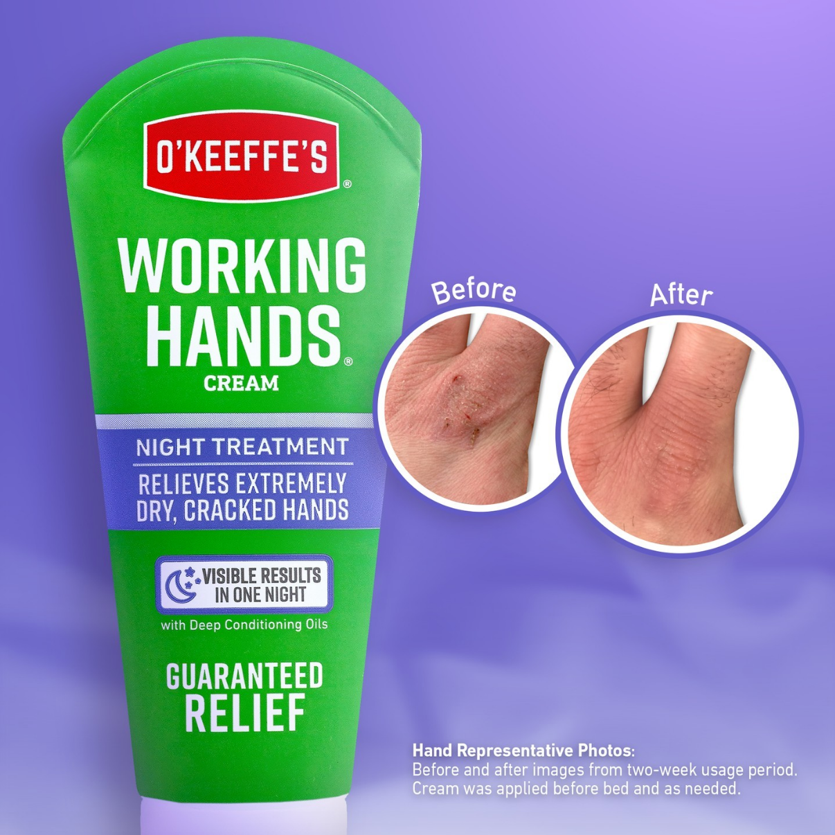 O'keeffe's Working Hands Cream, Night Treatment ครีมบำรุงมือ ลดอาการมือแห้ง เหี่ยว แตก คัน