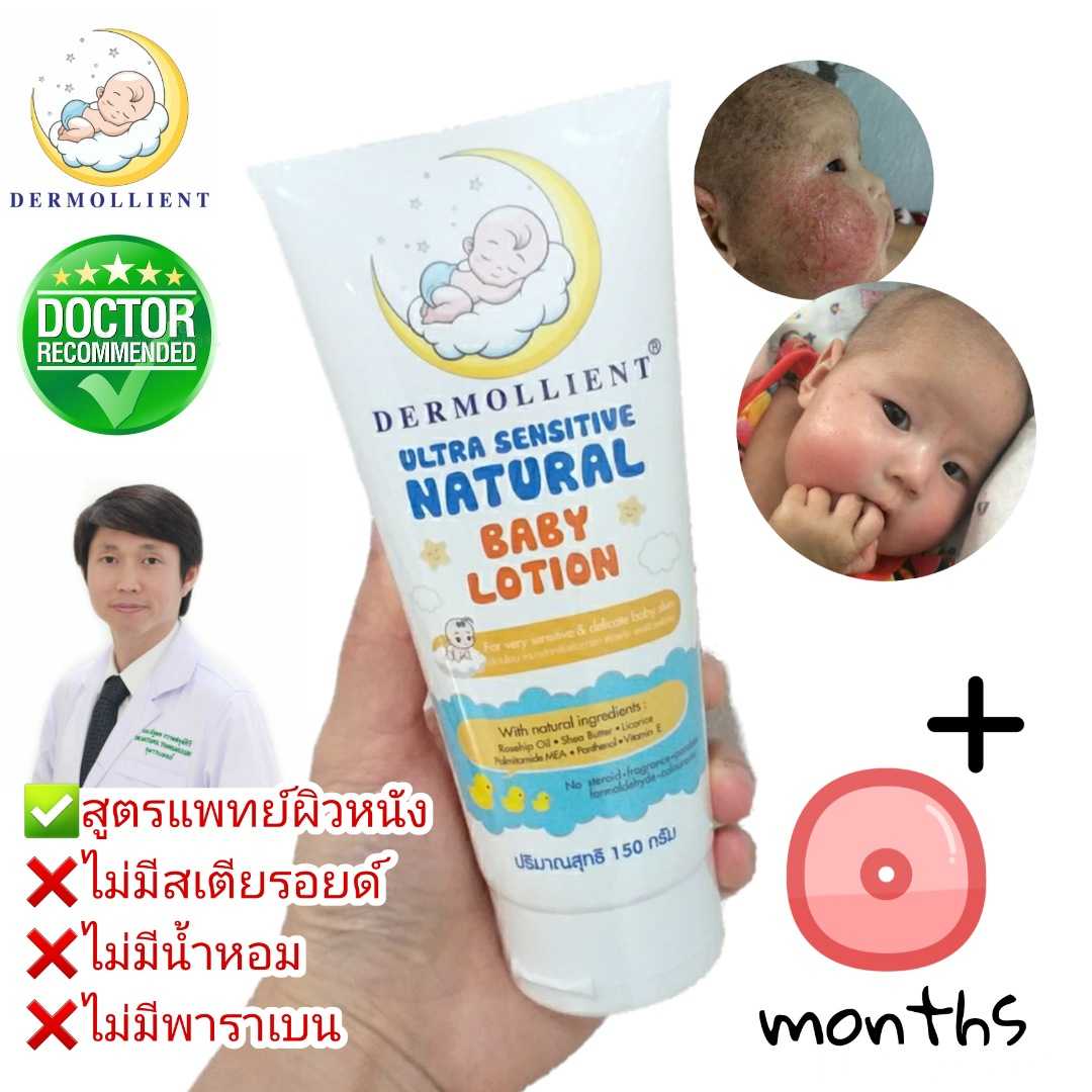 👨สูตรหมอ ลดผื่นภูมิแพ้คัน Dermollient Ultra​ Sensitive​ Natural​ Baby​ Lotion​ (150​ กรัม​) โลชั่นเ