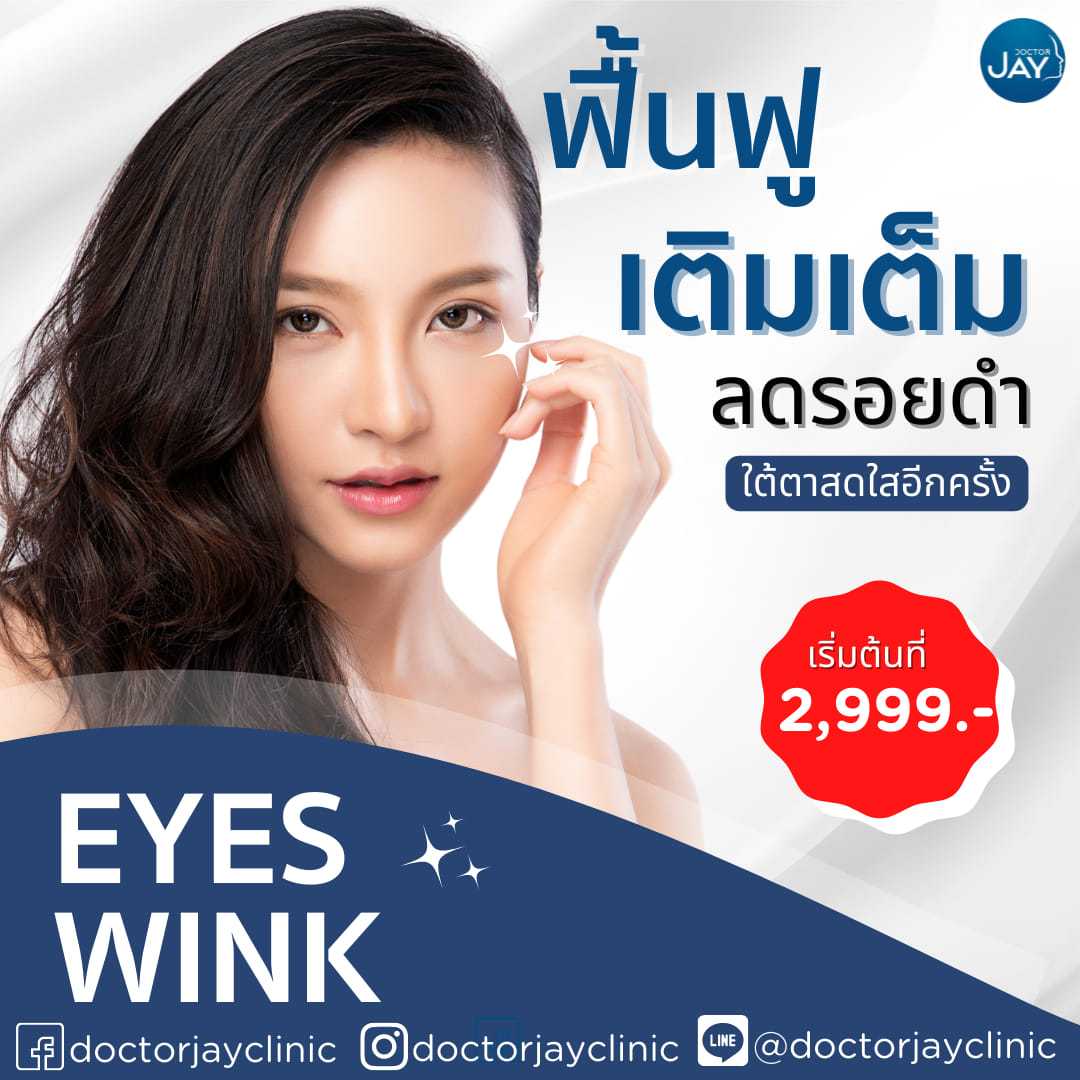 Eye Wink