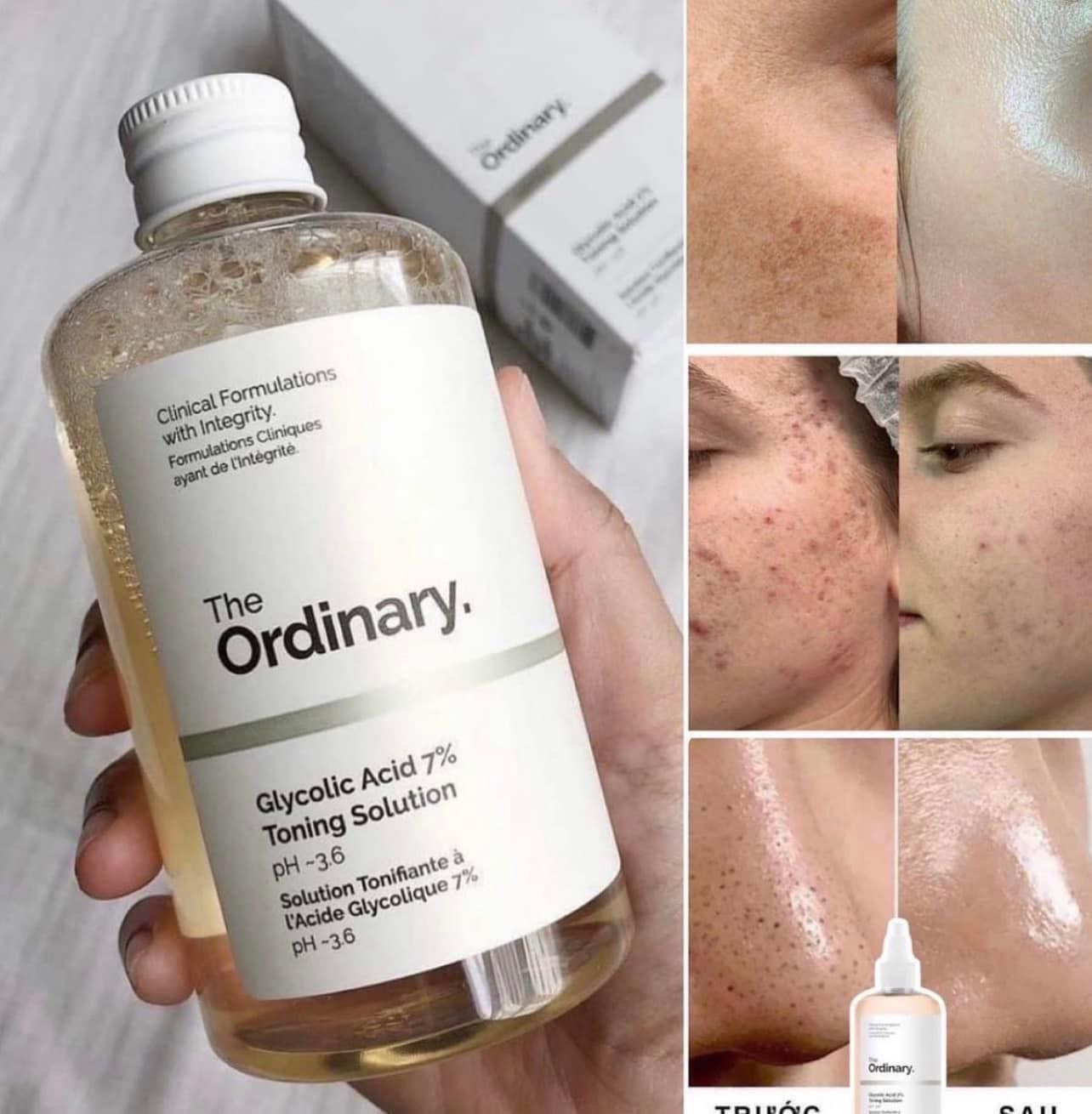 โทนเนอร์ The Ordinary Glycolic Acid 7% Toning Solution