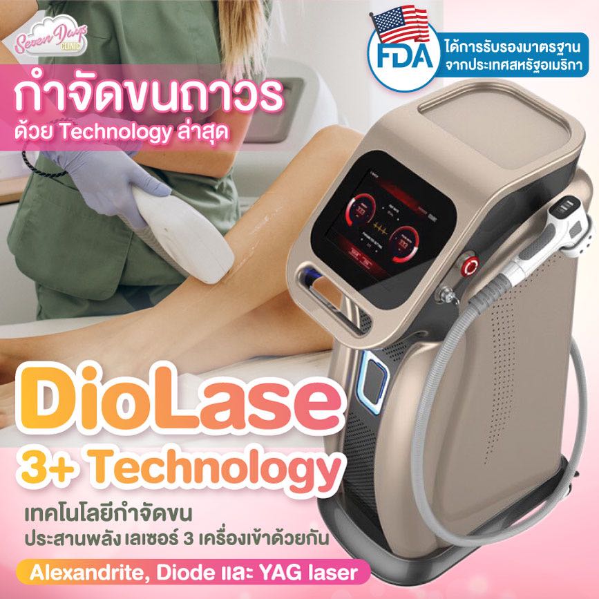 Diode 12 ครั้ง 6,000.- หนวด รักแร้