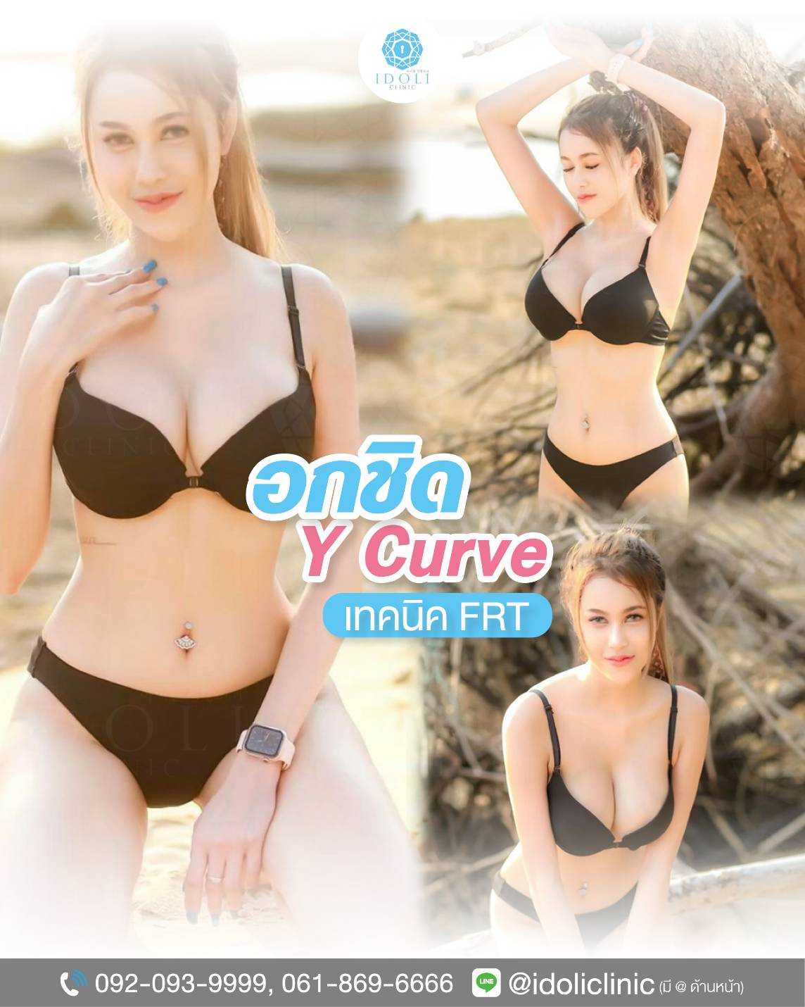 HOT🔥เสริมหน้าอก  ” FRTเทคนิค”