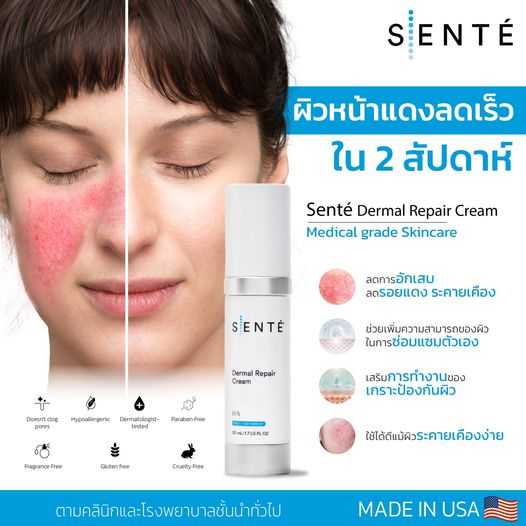 Sente Dermal Repair Cream 30 มล  สินค้าใหม่ ลด 20% สำหรับผู้ที่เห็็นข้อความนี้