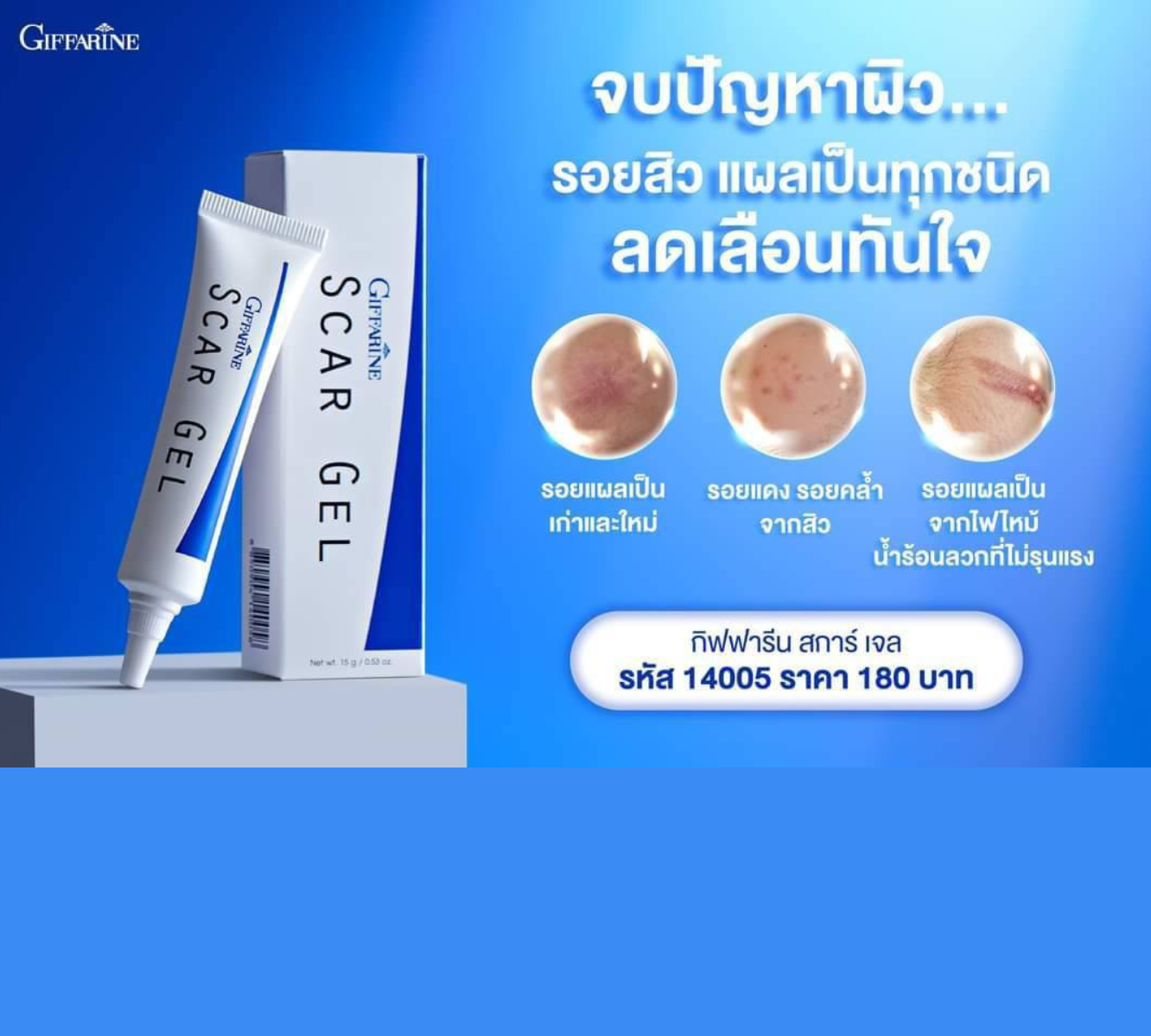 ♦️กิฟฟารีน สการ์ เจล