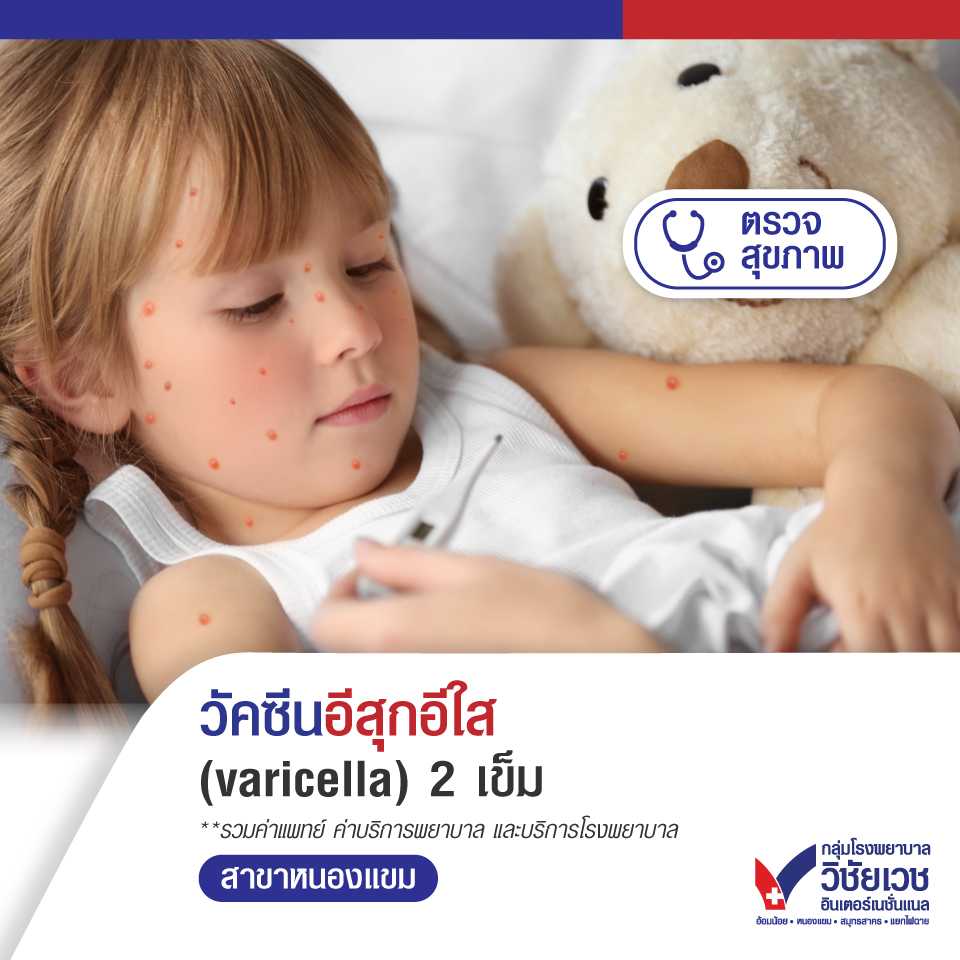 วัคซีนอีสุกอีใส (varicella) 2 เข็ม
