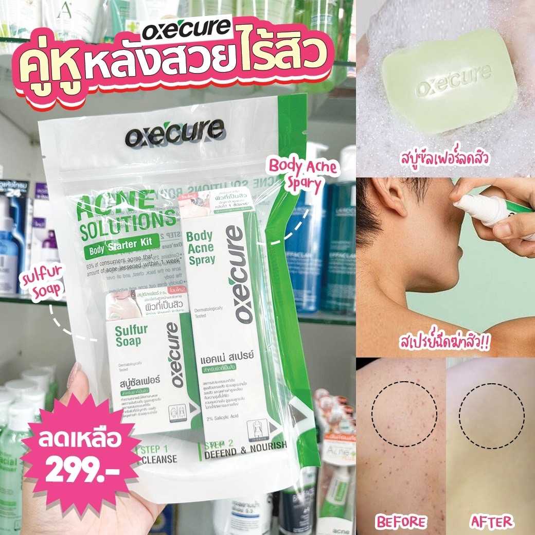 SET Oxecure body acne spray +สบู่ 30g (body starter kit) อกซีเคียว บอดี้ แอ็คเน่