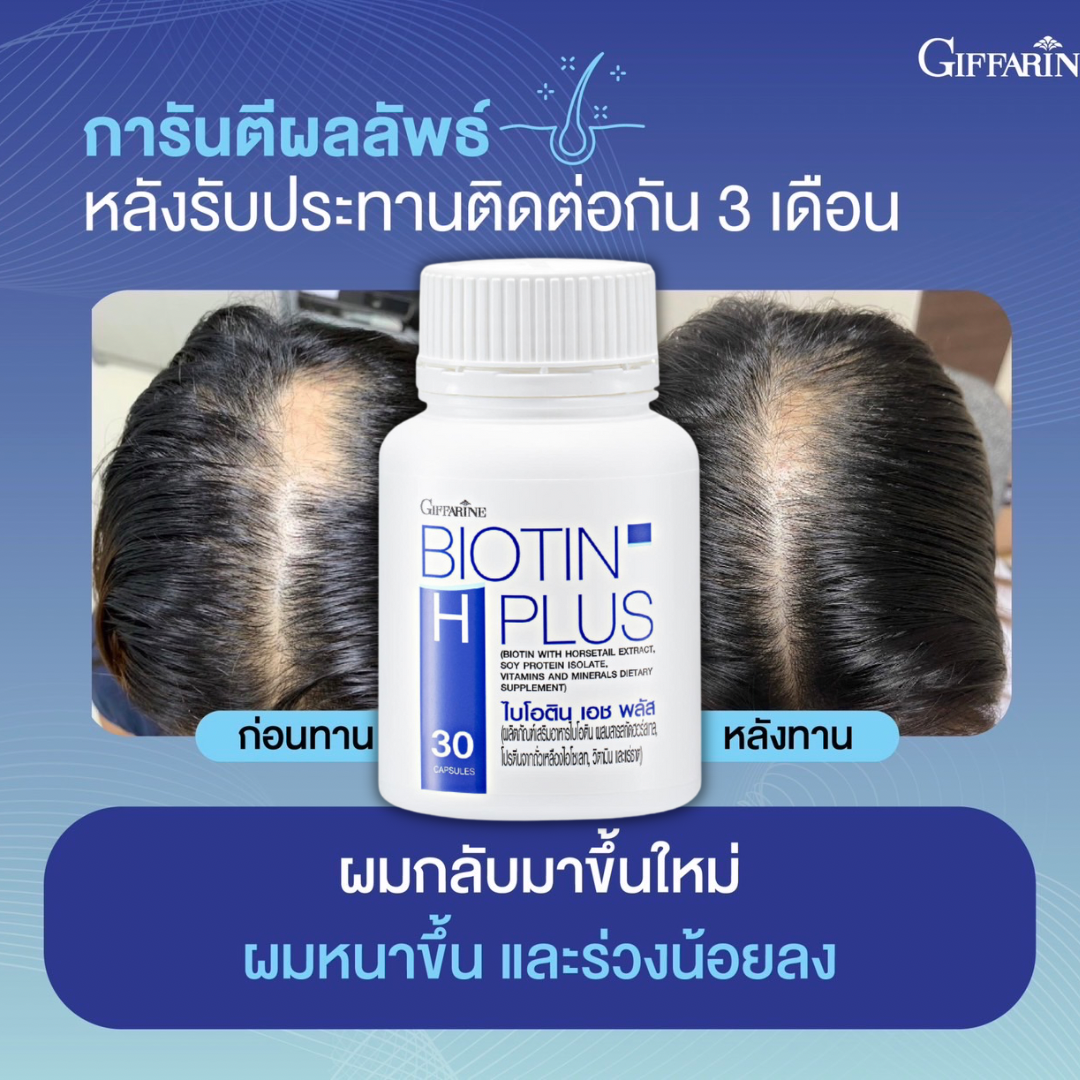 ไบโอติน เอช พลัส สำหรับผมบาง ลดผมร่วง ให้ รากผมแข็งแรง