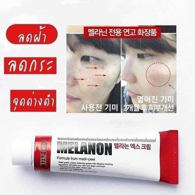 ครีมทาฝ้า  MEDI-PEEL melanon X cream 30m