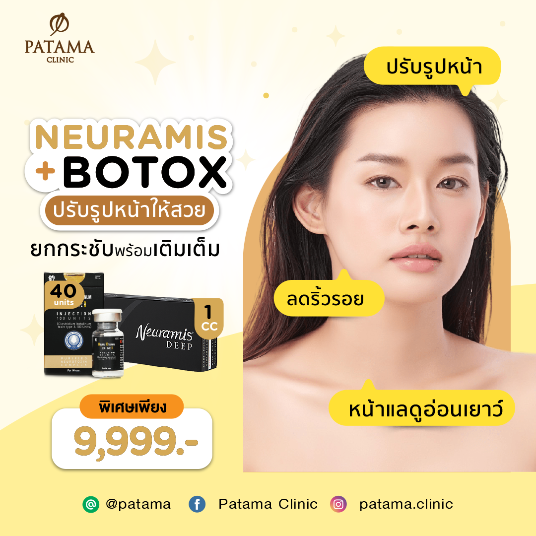 Neuramis + Botox